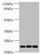 PRDX5 / Peroxiredoxin 5 Antibody - Western blot All lanes: PRDX5 antibody at 4µg/ml Lane 1: Mouse brain tissue Lane 2: Hela whole cell lysate Lane 3: 293T whole cell lysate Secondary Goat polyclonal to rabbit IgG at 1/10000 dilution Predicted band size: 23, 18, 13 kDa Observed band size: 23 kDa