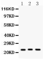 PRDX5 / Peroxiredoxin 5 Antibody - Peroxiredoxin 5 antibody Western blot. All lanes: Anti Peroxiredoxin 5 at 0.5 ug/ml. Lane 1: A549 Whole Cell Lysate at 40 ug. Lane 2: Rat Brain Tissue Lysate at 50 ug. Lane 3: Mouse Brain Tissue Lysate at 50 ug. Predicted band size: 22 kD. Observed band size: 22 kD.