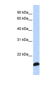 PRDX5 / Peroxiredoxin 5 Antibody - PRDX5 / Peroxiredoxin 5 antibody Western blot of Fetal Lung lysate. This image was taken for the unconjugated form of this product. Other forms have not been tested.
