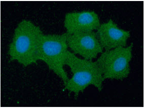 PRDX5 / Peroxiredoxin 5 Antibody - ICC/IF analysis of PRDX5 in Hep3B cells line, stained with DAPI (Blue) for nucleus staining and monoclonal anti-human PRDX5 antibody (1:100) with goat anti-mouse IgG-Alexa fluor 488 conjugate (Green).