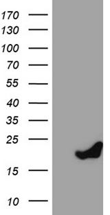 PRDX5 / Peroxiredoxin 5 Antibody - HEK293T cells were transfected with the pCMV6-ENTRY control. (Left lane) or pCMV6-ENTRY PRDX5. (Right lane) cDNA for 48 hrs and lysed