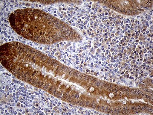 PRDX5 / Peroxiredoxin 5 Antibody - Immunohistochemical staining of paraffin-embedded Human appendix tissue within the normal limits using anti-PRDX5 mouse monoclonal antibody. (Heat-induced epitope retrieval by 1mM EDTA in 10mM Tris buffer. (pH8.5) at 120°C for 3 min. (1:250)
