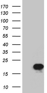 PRDX5 / Peroxiredoxin 5 Antibody - HEK293T cells were transfected with the pCMV6-ENTRY control. (Left lane) or pCMV6-ENTRY PRDX5. (Right lane) cDNA for 48 hrs and lysed