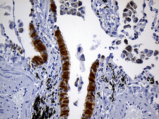 PRDX5 / Peroxiredoxin 5 Antibody - Immunohistochemical staining of paraffin-embedded Human lung tissue within the normal limits using anti-PRDX5 mouse monoclonal antibody. (Heat-induced epitope retrieval by 1mM EDTA in 10mM Tris buffer. (pH8.5) at 120°C for 3 min. (1:150)