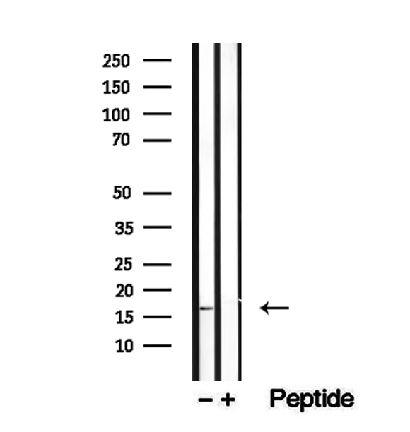 PRDX5 / Peroxiredoxin 5 Antibody - Western blot analysis of extracts of mouse liver tissue using PRX5 antibody.