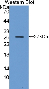 PRDX6 / Peroxiredoxin 6 Antibody