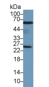 PRDX6 / Peroxiredoxin 6 Antibody