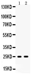 PRDX6 / Peroxiredoxin 6 Antibody - Peroxiredoxin 6 antibody Western blot. All lanes: Anti Peroxiredoxin 6 at 0.5 ug/ml. Lane 1: Mouse Liver Tissue Lysate at 50 ug. Lane 2: 293T Whole Cell Lysate at 40 ug. Predicted band size: 25 kD. Observed band size: 25 kD.