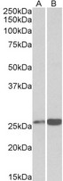 PRDX6 / Peroxiredoxin 6 Antibody - PRDX6 antibody (0.3 ug/ml) staining of Heart (A) and Liver (B) lysates (35 ug protein in RIPA buffer). Primary incubation was 1 hour. Detected by chemiluminescence.
