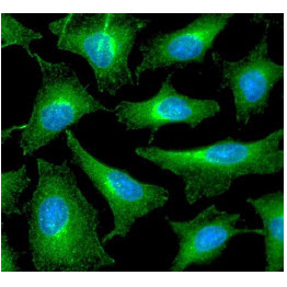 PRDX6 / Peroxiredoxin 6 Antibody - ICC/IF analysis of PRDX6 in HeLa cells line, stained with DAPI (Blue) for nucleus staining and monoclonal anti-human PRDX6 antibody (1:100) with goat anti-mouse IgG-Alexa fluor 488 conjugate (Green).