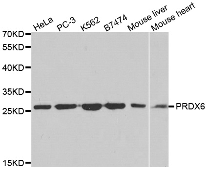 PRDX6 / Peroxiredoxin 6 Antibody - Western blot analysis of extracts of various cell lines.