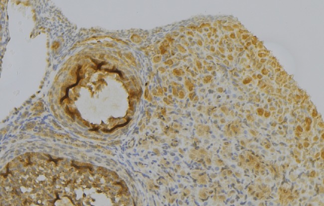 PRDX6 / Peroxiredoxin 6 Antibody - 1:100 staining human gastric tissue by IHC-P. The sample was formaldehyde fixed and a heat mediated antigen retrieval step in citrate buffer was performed. The sample was then blocked and incubated with the antibody for 1.5 hours at 22°C. An HRP conjugated goat anti-rabbit antibody was used as the secondary.