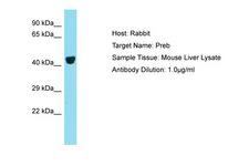 PREB Antibody -  This image was taken for the unconjugated form of this product. Other forms have not been tested.