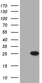 PRELID1 Antibody - HEK293T cells were transfected with the pCMV6-ENTRY control. (Left lane) or pCMV6-ENTRY PRELID1. (Right lane) cDNA for 48 hrs and lysed. Equivalent amounts of cell lysates. (5 ug per lane) were separated by SDS-PAGE and immunoblotted with anti-PRELID1. (1:2000)