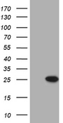 PRELID1 Antibody - HEK293T cells were transfected with the pCMV6-ENTRY control. (Left lane) or pCMV6-ENTRY PRELID1. (Right lane) cDNA for 48 hrs and lysed