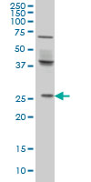 PRELID1 Antibody - PX19 monoclonal antibody (M01), clone 7B4 Western blot of PX19 expression in HeLa.