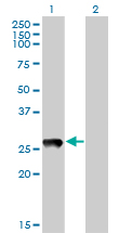 PRELID1 Antibody - Western blot of PX19 expression in transfected 293T cell line by PX19 monoclonal antibody (M01), clone 7B4.
