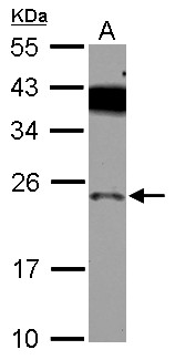 PRELID1 Antibody - Sample (30 ug of whole cell lysate) A: A549 12% SDS PAGE PRELID1 antibody diluted at 1:500