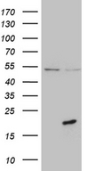 PRELID2 Antibody - HEK293T cells were transfected with the pCMV6-ENTRY control. (Left lane) or pCMV6-ENTRY PRELID2. (Right lane) cDNA for 48 hrs and lysed. Equivalent amounts of cell lysates. (5 ug per lane) were separated by SDS-PAGE and immunoblotted with anti-PRELID2. (1:500)