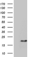 PRELID2 Antibody - HEK293T cells were transfected with the pCMV6-ENTRY control. (Left lane) or pCMV6-ENTRY PRELID2. (Right lane) cDNA for 48 hrs and lysed. Equivalent amounts of cell lysates. (5 ug per lane) were separated by SDS-PAGE and immunoblotted with anti-PRELID2. (1:2000)