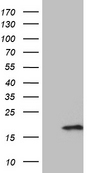 PRELID2 Antibody - HEK293T cells were transfected with the pCMV6-ENTRY control. (Left lane) or pCMV6-ENTRY PRELID2. (Right lane) cDNA for 48 hrs and lysed. Equivalent amounts of cell lysates. (5 ug per lane) were separated by SDS-PAGE and immunoblotted with anti-PRELID2. (1:2000)