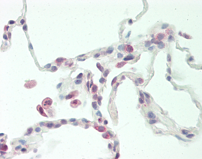 PRELP / Prolargin Antibody - Human Lung: Formalin-Fixed, Paraffin-Embedded (FFPE).  This image was taken for the unconjugated form of this product. Other forms have not been tested.