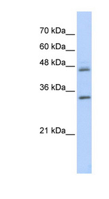 PRELP / Prolargin Antibody - PRELP antibody Western blot of Transfected 293T cell lysate. This image was taken for the unconjugated form of this product. Other forms have not been tested.