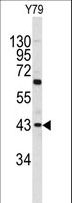 PRELP / Prolargin Antibody - Western blot of PRELP antibody in Y79 cell line lysates (35 ug/lane). PRELP (arrow) was detected using the purified antibody.