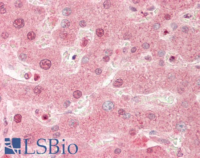 PREP / Prolyl Endopeptidase Antibody - Human Liver: Formalin-Fixed, Paraffin-Embedded (FFPE).  This image was taken for the unconjugated form of this product. Other forms have not been tested.