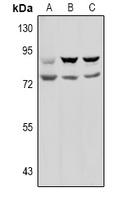 PREP / Prolyl Endopeptidase Antibody - Western blot analysis of Prolyl Endopeptidase expression in HEK293T (A), U87MG (B), MCF7 (C) whole cell lysates.