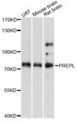 PREPL Antibody - Western blot analysis of extracts of various cell lines, using PREPL antibody at 1:3000 dilution. The secondary antibody used was an HRP Goat Anti-Rabbit IgG (H+L) at 1:10000 dilution. Lysates were loaded 25ug per lane and 3% nonfat dry milk in TBST was used for blocking. An ECL Kit was used for detection and the exposure time was 10s.