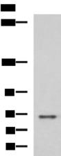 PREPL Antibody - Western blot analysis of RAW264.7 cell lysate  using PREPL Polyclonal Antibody at dilution of 1:800