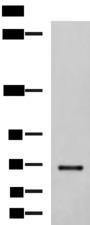 PREPL Antibody - Western blot analysis of NIH/3T3 cell lysate  using PREPL Polyclonal Antibody at dilution of 1:850