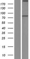 PREPL Protein - Western validation with an anti-DDK antibody * L: Control HEK293 lysate R: Over-expression lysate
