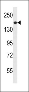 PREX1 / P-REX1 Antibody - PREX1 Antibody western blot of NCI-H460 cell line lysates (35 ug/lane). The PREX1 antibody detected the PREX1 protein (arrow).