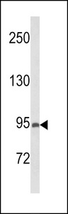 PREX1 / P-REX1 Antibody - Western blot of PREX1 Antibody in MCF-7 cell line lysates (35 ug/lane). PREX1 (arrow) was detected using the purified antibody.