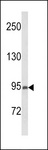 PREX1 / P-REX1 Antibody - Western blot of PREX1 Antibody in MCF-7 cell line lysates (35 ug/lane). PREX1 (arrow) was detected using the purified antibody.