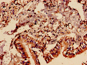 PREX1 / P-REX1 Antibody - Immunocytochemistry analysis of human lung tissue diluted at 1:100
