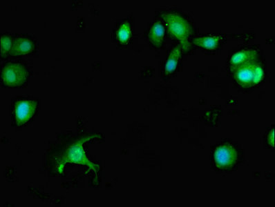 PREX1 / P-REX1 Antibody - Immunofluorescent analysis of MCF-7 cells diluted at 1:100 and Alexa Fluor 488-congugated AffiniPure Goat Anti-Rabbit IgG(H+L)