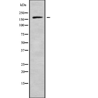 PREX1 / P-REX1 Antibody - Western blot analysis of PREX1 using HuvEc whole cells lysates