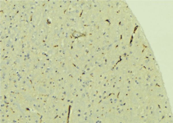 PREX1 / P-REX1 Antibody - 1:100 staining mouse brain tissue by IHC-P. The sample was formaldehyde fixed and a heat mediated antigen retrieval step in citrate buffer was performed. The sample was then blocked and incubated with the antibody for 1.5 hours at 22°C. An HRP conjugated goat anti-rabbit antibody was used as the secondary.