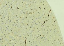 PREX1 / P-REX1 Antibody - 1:100 staining mouse brain tissue by IHC-P. The sample was formaldehyde fixed and a heat mediated antigen retrieval step in citrate buffer was performed. The sample was then blocked and incubated with the antibody for 1.5 hours at 22°C. An HRP conjugated goat anti-rabbit antibody was used as the secondary.