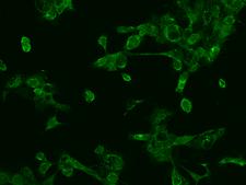 PREX1 / P-REX1 Antibody - Immunofluorescence staining of PREX1 in A431 cells. Cells were fixed with 4% PFA, permeabilzed with 0.1% Triton X-100 in PBS, blocked with 10% serum, and incubated with rabbit anti-Human PREX1 polyclonal antibody (dilution ratio 1:100) at 4°C overnight. Then cells were stained with the Alexa Fluor 488-conjugated Goat Anti-rabbit IgG secondary antibody (green). Positive staining was localized to Cytoplasm.