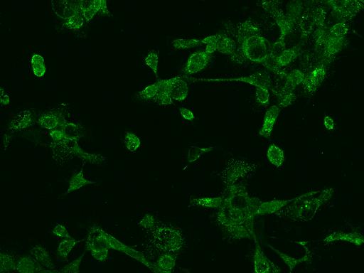 PREX1 / P-REX1 Antibody - Immunofluorescence staining of PREX1 in A431 cells. Cells were fixed with 4% PFA, permeabilzed with 0.1% Triton X-100 in PBS, blocked with 10% serum, and incubated with rabbit anti-Human PREX1 polyclonal antibody (dilution ratio 1:100) at 4°C overnight. Then cells were stained with the Alexa Fluor 488-conjugated Goat Anti-rabbit IgG secondary antibody (green). Positive staining was localized to Cytoplasm.