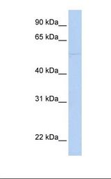 PRF1 / Perforin Antibody - MCF7 cell lysate. Antibody concentration: 1.0 ug/ml. Gel concentration: 12%.  This image was taken for the unconjugated form of this product. Other forms have not been tested.