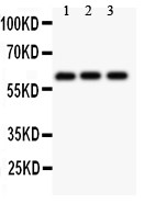 PRF1 / Perforin Antibody - Perforin antibody Western blot. All lanes: Anti Perforin at 0.5 ug/ml. Lane 1: HELA Whole Cell Lysate at 40 ug. Lane 2: COLO320 Whole Cell Lysate at 40 ug. Lane 3: HEPG2 Whole Cell Lysate at 40 ug. Predicted band size: 61 kD . Observed band size: 61 kD.