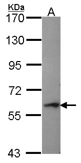 PRF1 / Perforin Antibody - Sample (30 ug of whole cell lysate). A: Hep G2 . 7.5% SDS PAGE. Perforin 1 antibody. Perforin antibody diluted at 1:1000.