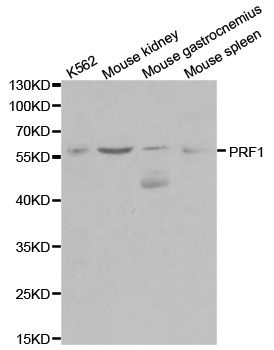 PRF1 / Perforin Antibody - Western blot analysis of extracts of various cell lines, using PRF1 antibody.