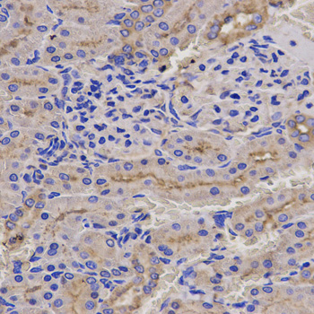 PRF1 / Perforin Antibody - Immunohistochemistry of paraffin-embedded rat kidney using PRF1 antibody at dilution of 1:200 (x400 lens).