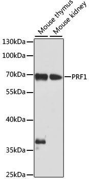 PRF1 / Perforin Antibody - Western blot analysis of extracts of various cell lines, using PRF1 antibody at 1:1000 dilution. The secondary antibody used was an HRP Goat Anti-Rabbit IgG (H+L) at 1:10000 dilution. Lysates were loaded 25ug per lane and 3% nonfat dry milk in TBST was used for blocking. An ECL Kit was used for detection and the exposure time was 30s.